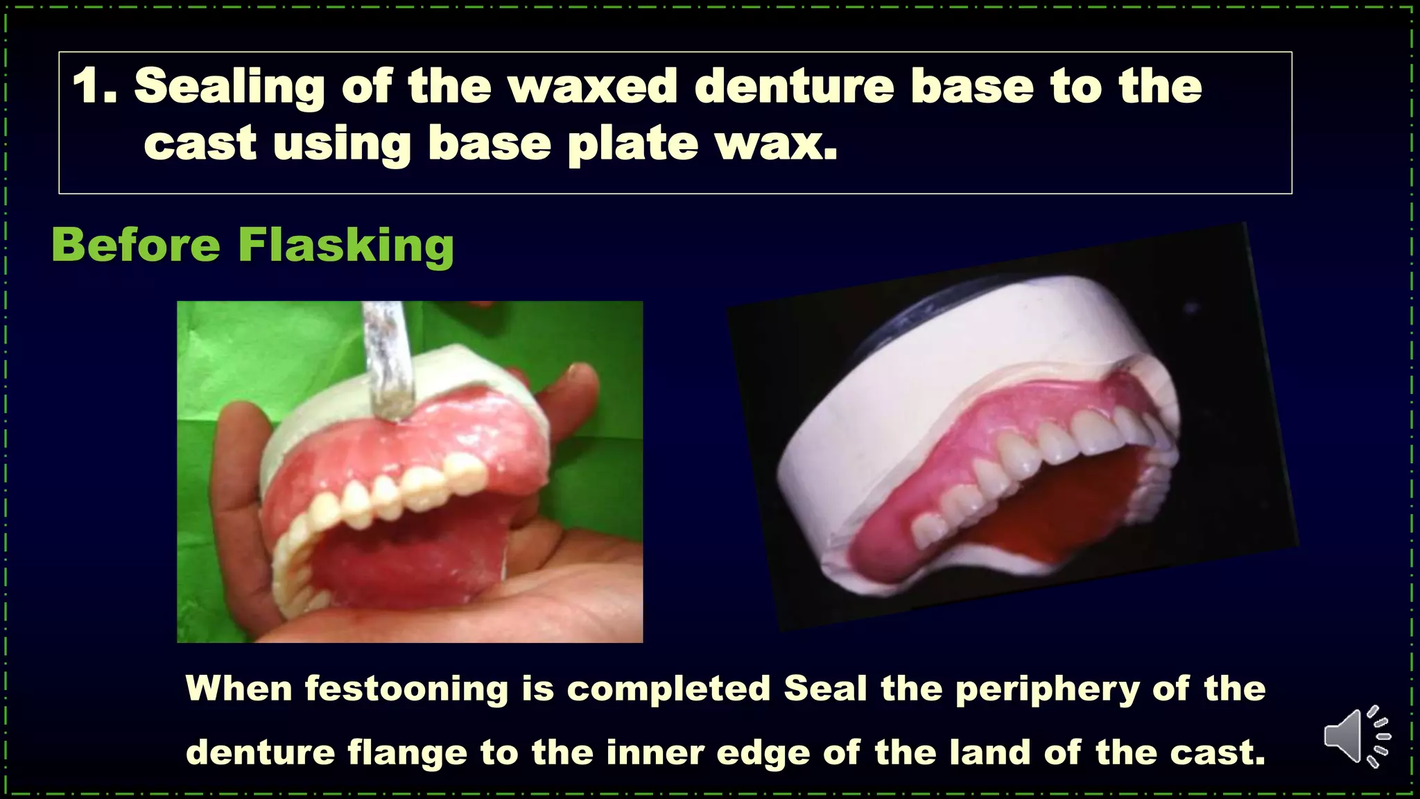 1. Sealing of the waxed denture base to the
cast using base plate wax.
When festooning is completed Seal the periphery of the
denture flange to the inner edge of the land of the cast.
Before Flasking
 