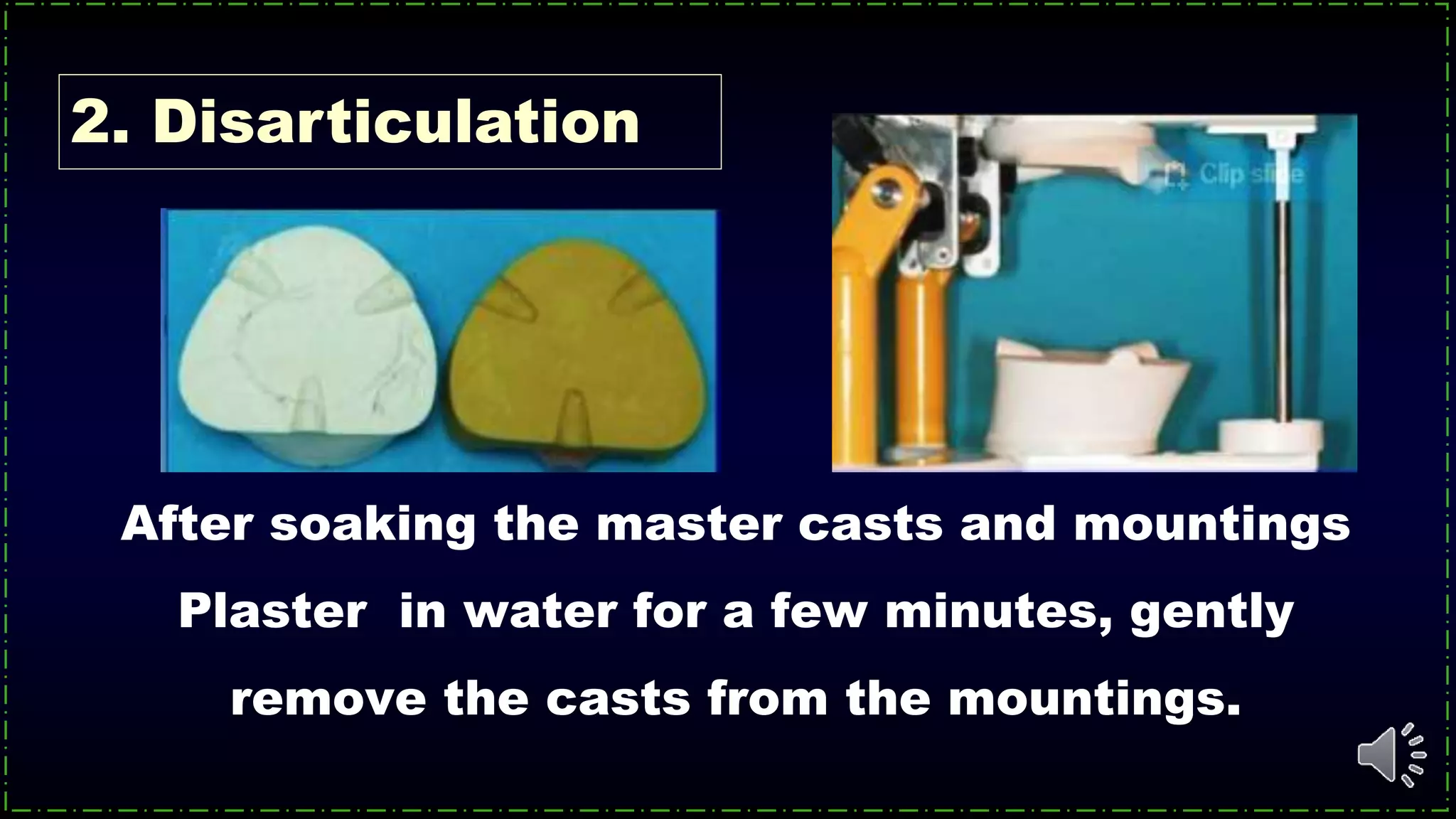 After soaking the master casts and mountings
Plaster in water for a few minutes, gently
remove the casts from the mountings.
2. Disarticulation
 