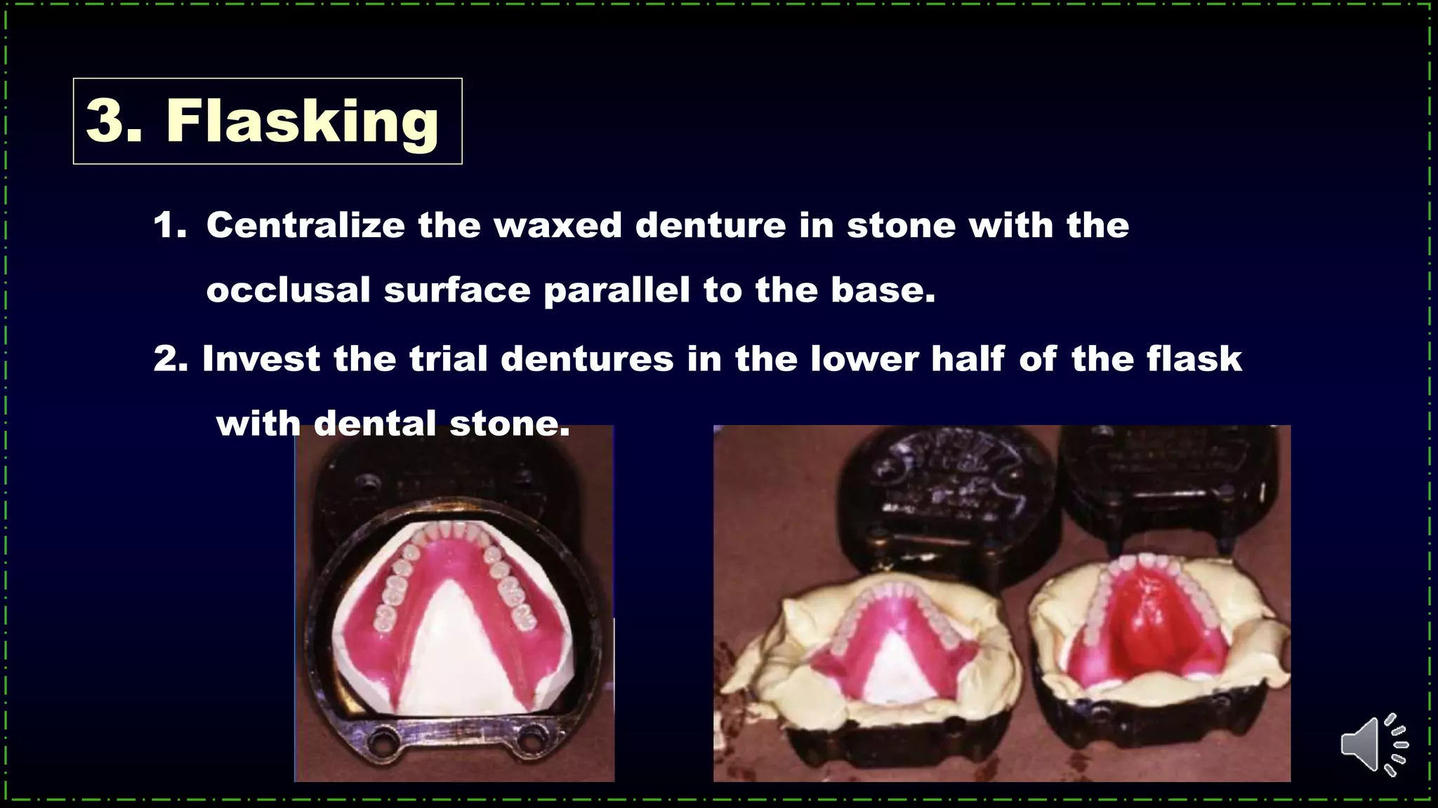 3. Flasking
1. Centralize the waxed denture in stone with the
occlusal surface parallel to the base.
2. Invest the trial dentures in the lower half of the flask
with dental stone.
 