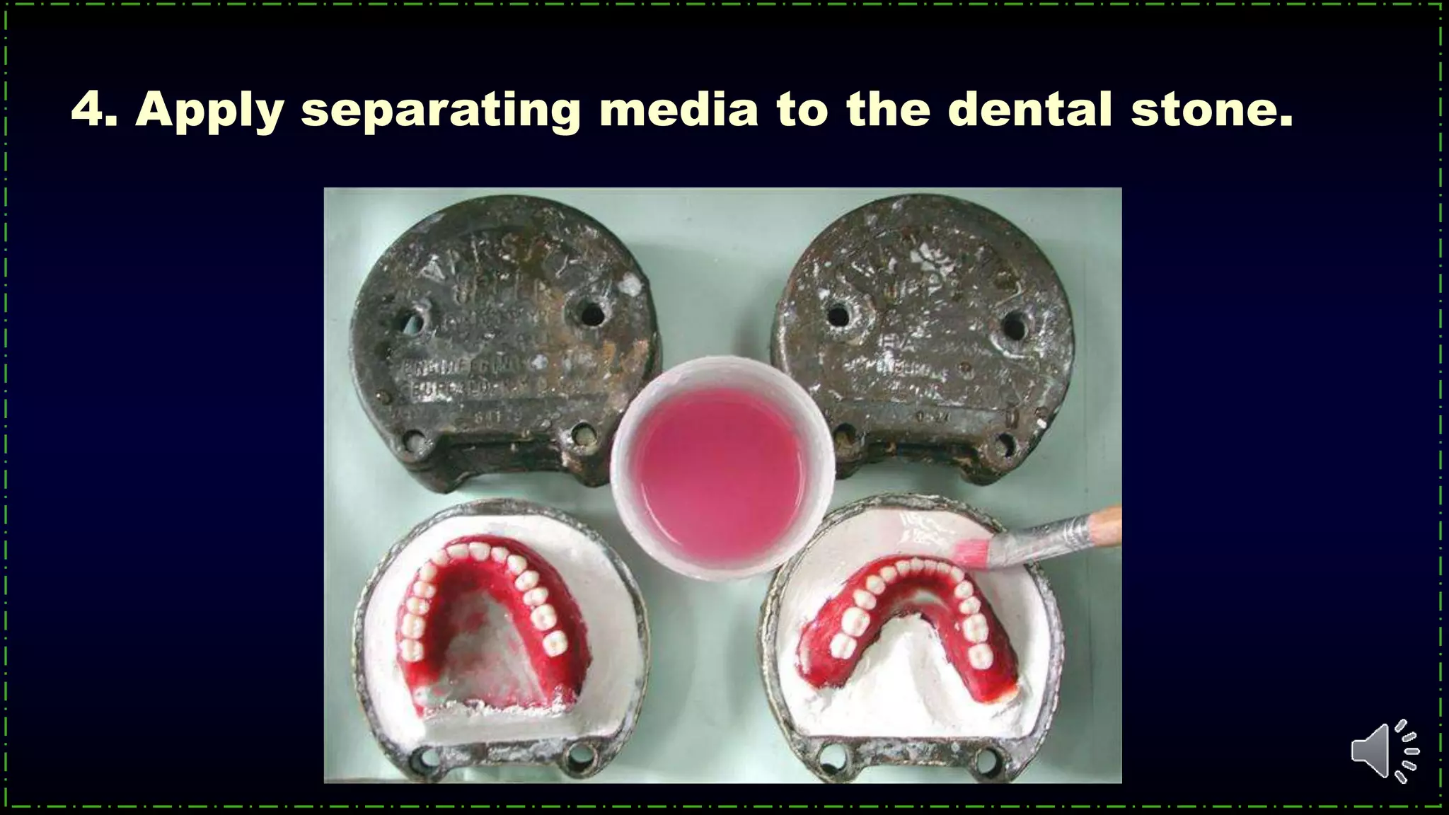 4. Apply separating media to the dental stone.
 