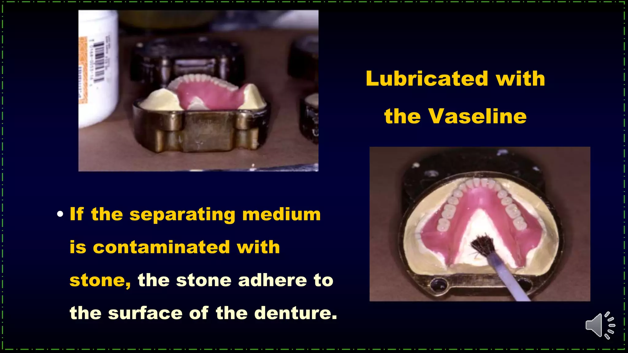 Lubricated with
the Vaseline
• If the separating medium
is contaminated with
stone, the stone adhere to
the surface of the denture.
 