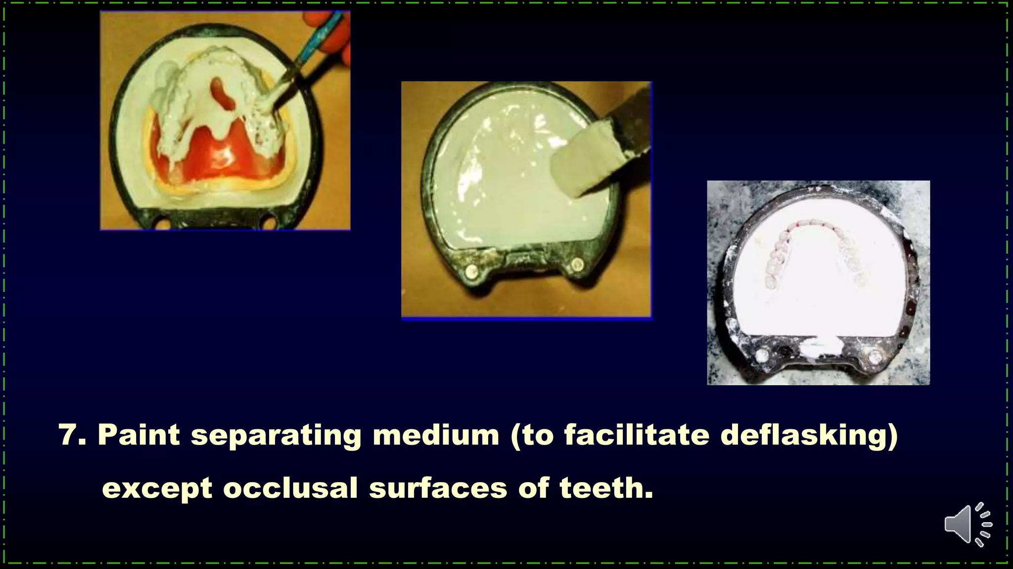7. Paint separating medium (to facilitate deflasking)
except occlusal surfaces of teeth.
 