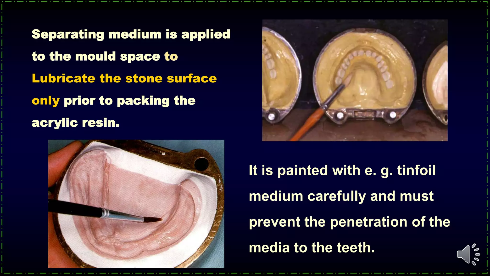 It is painted with e. g. tinfoil
medium carefully and must
prevent the penetration of the
media to the teeth.
Separating medium is applied
to the mould space to
Lubricate the stone surface
only prior to packing the
acrylic resin.
 
