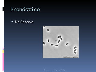 Pronóstico

 De Reserva




               Departamento de Agentes Biológicos
 
