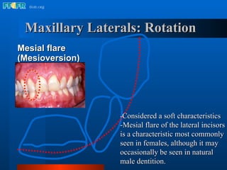 Mesial Rotation 12.esthetics&characterization | PPT