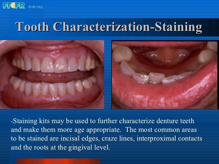 12.esthetics&characterization