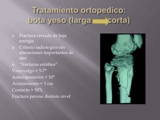 Fractura de PiernaMecanismo:Indirecto-rotacional.