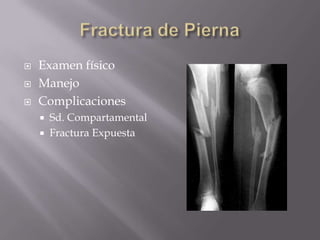 Fractura de PiernaExamen físicoManejoComplicacionesSd. CompartamentalFractura Expuesta