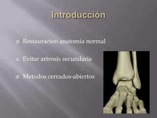 Fractura de PiernaIndicaciones del tto. quirúrgico:Fractura expuesta.