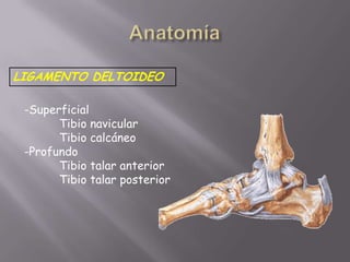 Fractura irreductible.