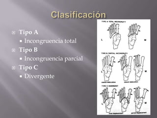 Estabilidad  combinada:  ÓSEA  +  CAPSULO-LIGAMENTOSA.Membrana interoseaSindesmosisT-P distalComplejos Ligamentarioscolaterales