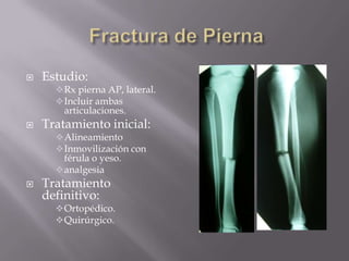 Frecuente Fx expuestas