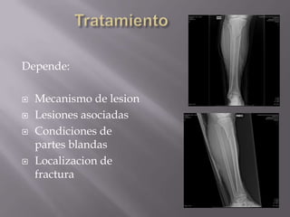 Membrana interosea, evita desplazamiento axial y lateral.SignosDolor intenso. Impotencia funcional.Edema. Equímosis. Crépito óseo con los intentos de movilizar la pierna. Frecuente desviación de los ejes: angulación y rotación del segmento distal. Movilidad anormal de los fragmentos. Bulas, generalmente de contenido sanguinolento.