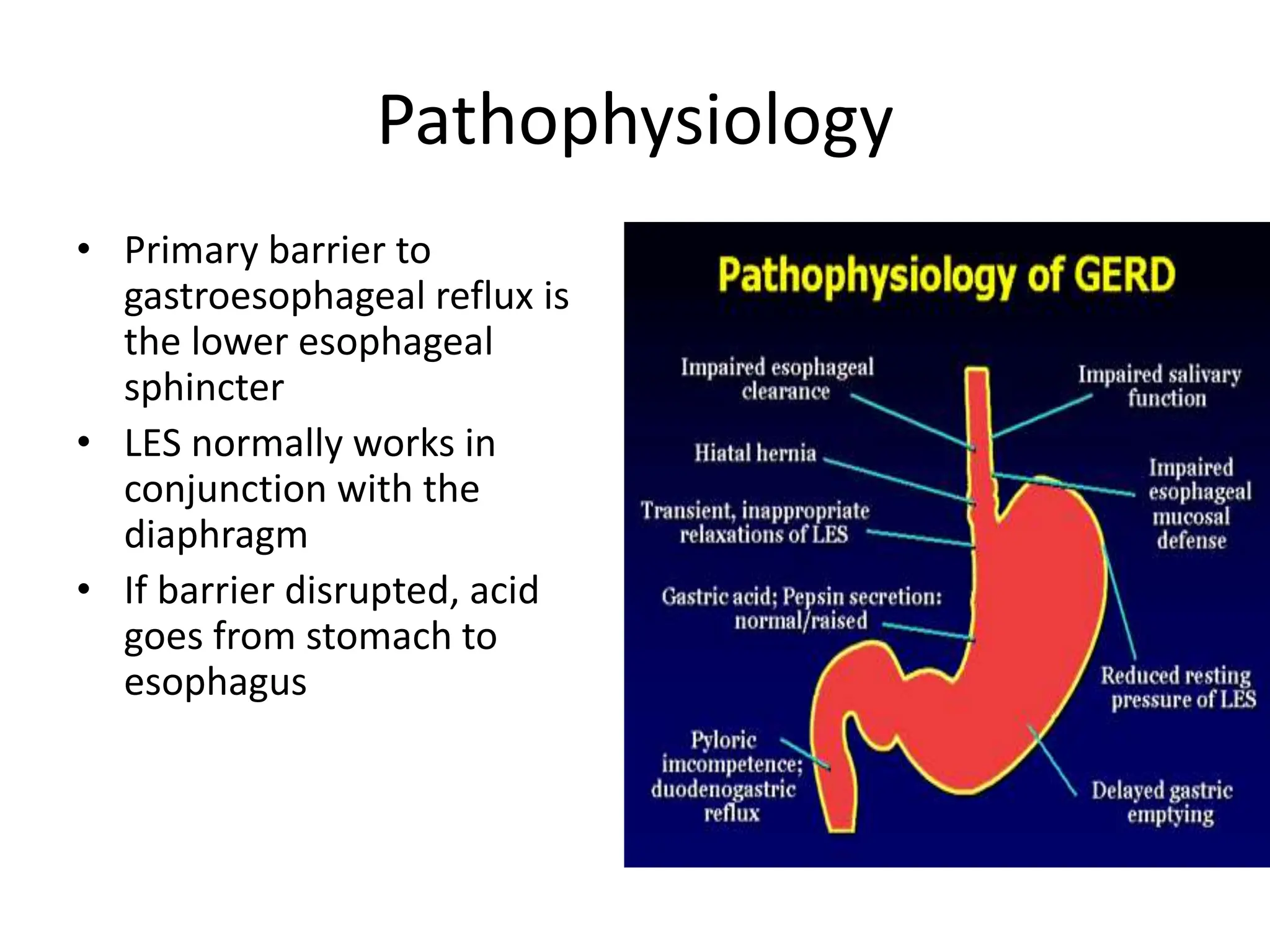 Pathophysiology
• Primary barrier to
gastroesophageal reflux is
the lower esophageal
sphincter
• LES normally works in
conjunction with the
diaphragm
• If barrier disrupted, acid
goes from stomach to
esophagus
 