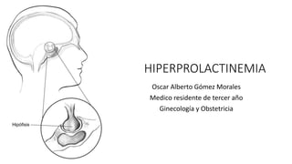HIPERPROLACTINEMIA
Oscar Alberto Gómez Morales
Medico residente de tercer año
Ginecología y Obstetricia
 