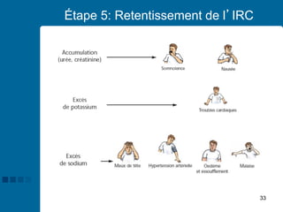 33
Étape 5: Retentissement de l’IRC
 