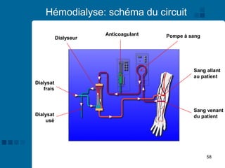 58
Hémodialyse: schéma du circuit
Pompe à sang
Anticoagulant
Sang allant
au patient
Sang venant
du patient
Dialyseur
Dialysat
frais
Dialysat
usé
 