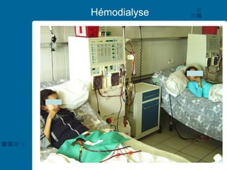 61
Hémodialyse
 