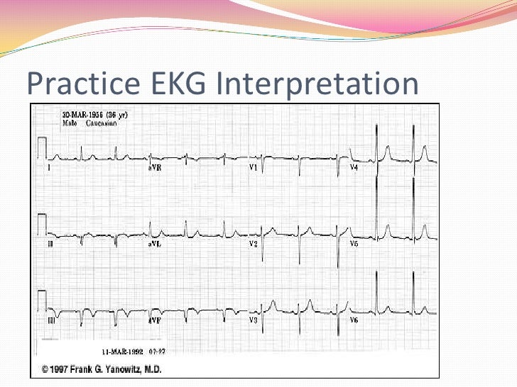 12 lead ecg interpretation pdf