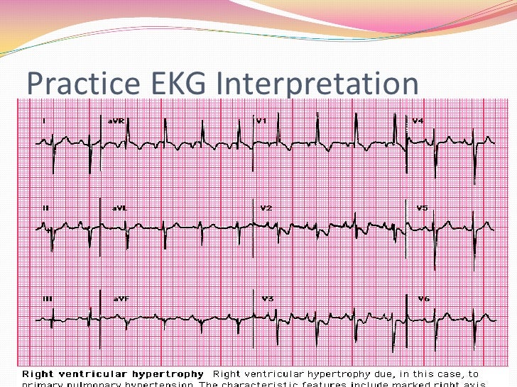 12 Lead EKG Interpretation