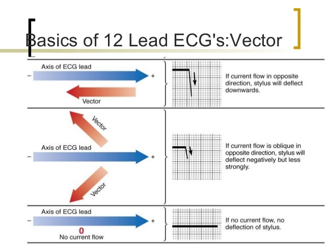 Introduction To 12-Lead ECG: The Art Of Interpretation, Garcia, Tomas B. Book Introduction To 12-Lead ECG: The Art Of Interpretation, Garcia, Tomas B. Book
