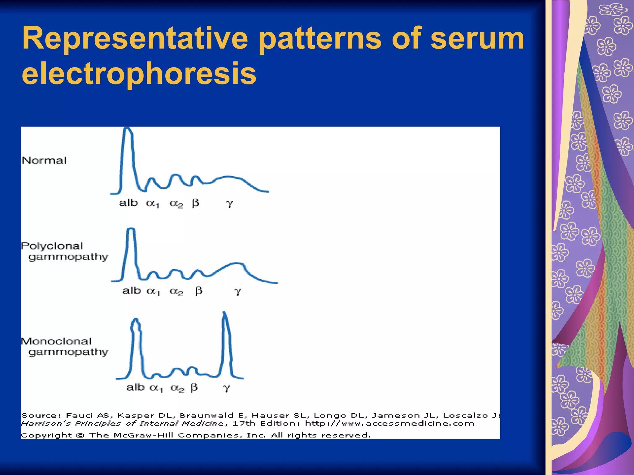 Representative patterns of serum electrophoresis   