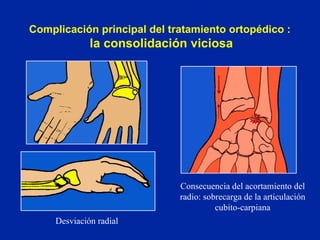 Complicación principal del tratamiento ortopédico :  la consolidación viciosa Consecuencia del acortamiento del radio: sobrecarga de la articulación cubito-carpiana Desviación radial 