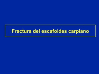 Fractura del escafoides carpiano 