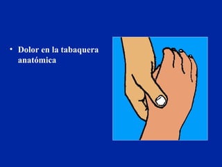Dolor en la tabaquera anatómica 
