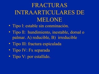 FRACTURAS INTRAARTICULARES DE MELONE Tipo l: estable sin conminación. Tipo ll:  hundimiento, inestable, dorsal o palmar. A) reducible, B)  irreducible Tipo lll: fractura espiculada Tipo lV: Fx separada Tipo V: por estallido. 