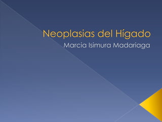 Neoplasias del Hígado Marcia Isimura Madariaga 