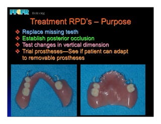 Crown Rpd Rest 12.(new)surveyed crowns and combined fixed rpd cases | PDF