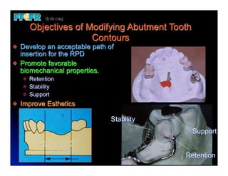 12.(new)surveyed crowns and combined fixed rpd cases | PDF
