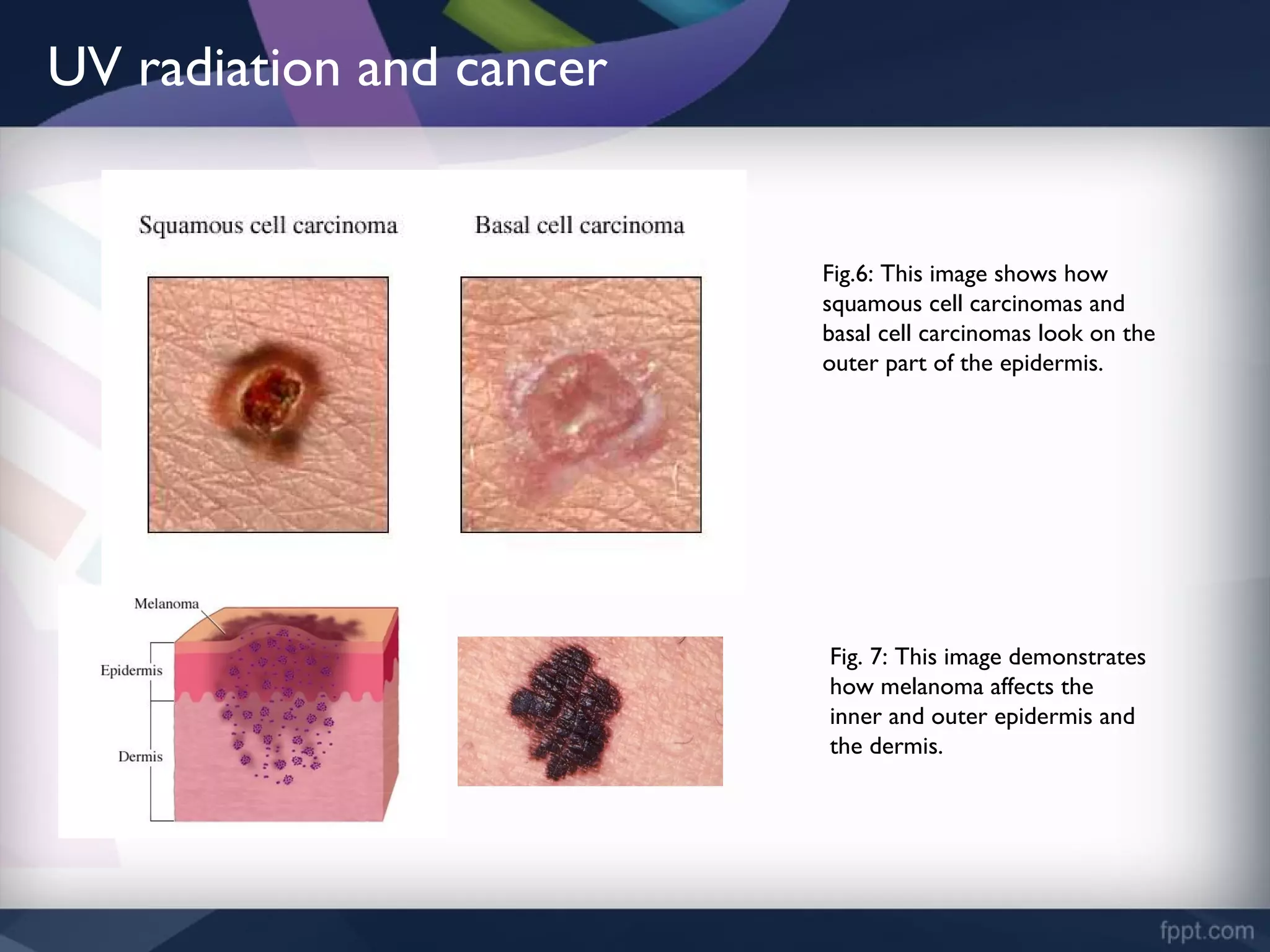 DNA Damage Caused by Ultraviolet Radiation | PPT