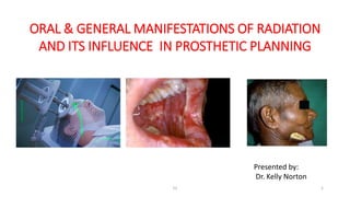 ORAL & GENERAL MANIFESTATIONS OF RADIATION
AND ITS INFLUENCE IN PROSTHETIC PLANNING
52 1
Presented by:
Dr. Kelly Norton
 