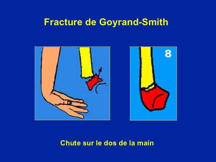 Fait mal à la poitrine et le dos au soupir
