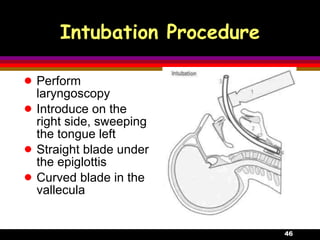 12.Respiratory Failure | PPT