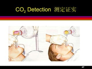 Pco2 Testing Carilion 12.Respiratory Failure | PPT