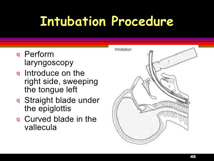 12.Respiratory Failure