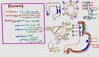 stomach surgery for medical students 