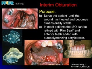 Interim Obturation
Purpose:
b) Serve the patient until the
   wound has healed and becomes
   dimensionally stable.
c) In most patients the ISO can be
   relined with Rim Seal* and
   anterior teeth added with
   autopolymerizing acrylic resin.




                     *Rim Seal, Harry J.
                     Bosworth Co., Skokie, IL
 