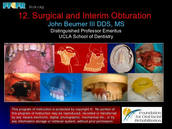 Surgical and Interim Obturation