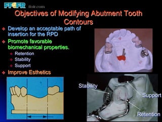 12.surveyed crowns and combined fixed rpd cases | PDF