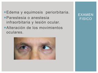 Edema y equimosis periorbitaria.
                                    EXAMEN
Parestesia o anestesia              FISICO
 infraorbitaria y lesión ocular.
Alteración de los movimientos
 oculares.
 