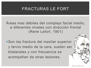 FRACTURAS LE FORT


Áreas mas débiles del complejo facial medio,
  a diferentes niveles con dirección frontal
             (Rene Lefort, 1901)

Son las fractura del maxilar superior
 y tercio medio de la cara, suelen ser
 bilaterales y con frecuencia se
 acompañan de otras lesiones.
 