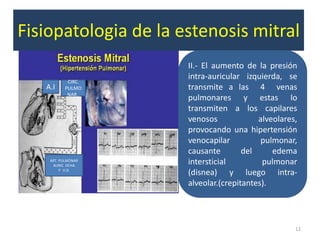 Fisiopatologia de la estenosis mitral
                      II.- El aumento de la presión
            CIRC.
                      intra-auricular izquierda, se
   A.I     PULMO      transmite a las 4 venas
            NAR..
                      pulmonares y estas lo
                      transmiten a los capilares
                      venosos             alveolares,
                      provocando una hipertensión
                      venocapilar          pulmonar,
                      causante        del     edema
    ART. PULMONAR
     AURIC. DCHA.
                      intersticial         pulmonar
         Y V.D.
                      (disnea) y luego intra-
                      alveolar.(crepitantes).




                                                    12
 