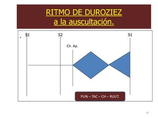 RITMO DE DUROZIEZ
           a la auscultación.
.   S1      S2                                      S1

                 Ch. Ap.




                           PUN – TAC – CH – RUUT.


                                                         18
 