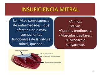 INSUFICIENCIA MITRAL
.    La I.M.es consecuencia           •Anillos.
     de enfermedades, que              •Valvas.
       afectan uno o mas        •Cuerdas tendinosas.
          componentes           •Músculos papilares.
    funcionales de la válvula       •Y Miocardio
         mitral, que son:           subyacente.




                                                       27
 