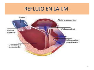 REFLUJO EN LA I.M.




                     40
 