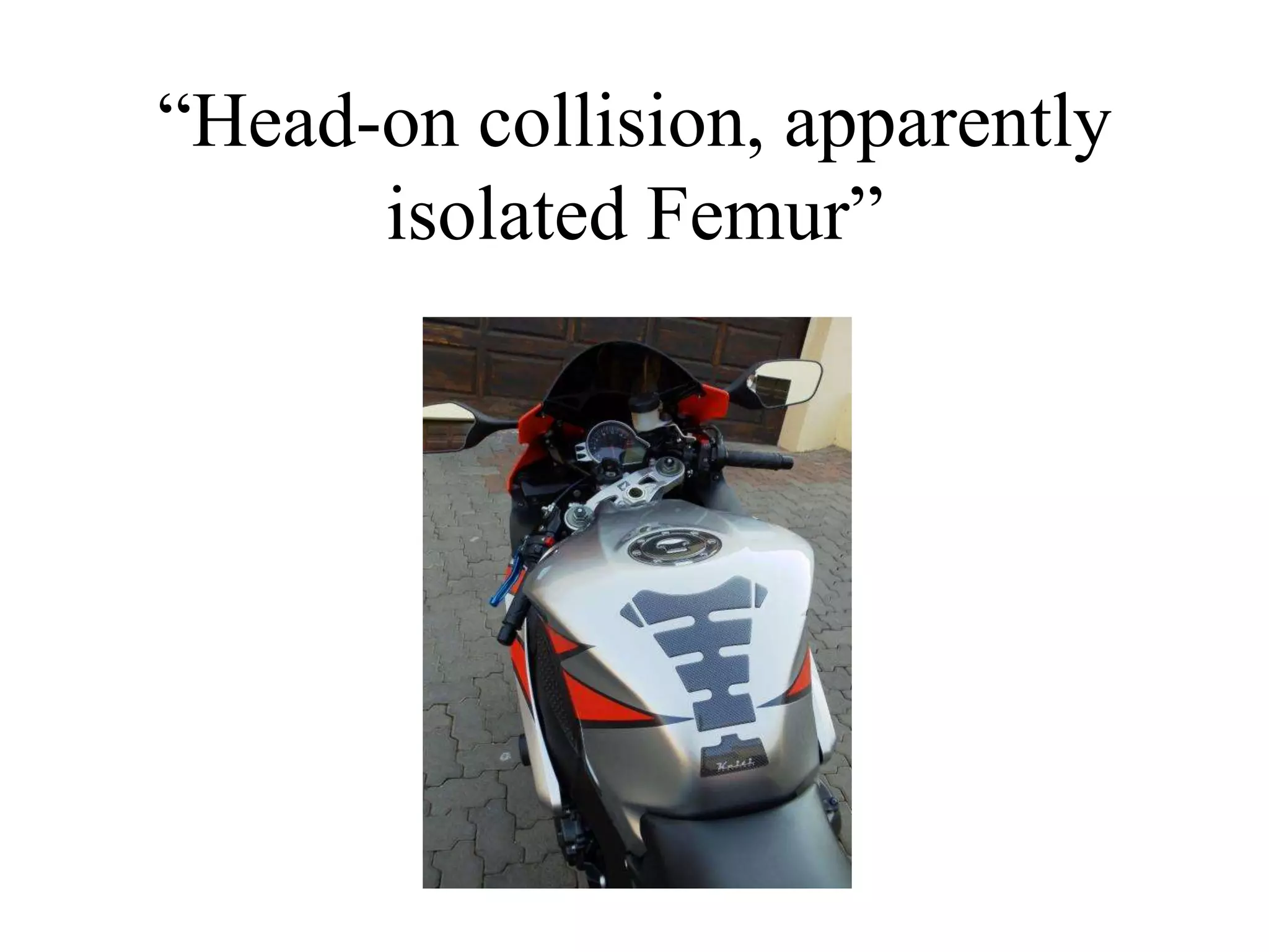“Head-on collision, apparently
isolated Femur”
 